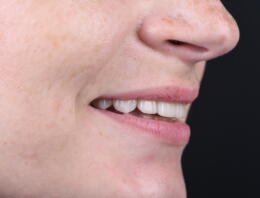 "